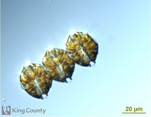 Photo of Alexandrium catenella